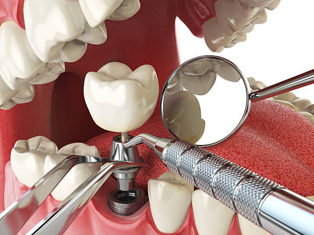 Best Emergency Denture Repair in Wolfhurst, OH
